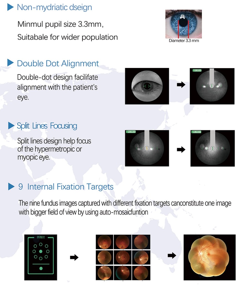 factory price for the auto Capture and Auto Flash Fundus Camera for Retinal Examination
