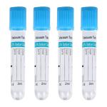 Phlebotomy Anticoagulant Vacuum Blood Sample Collection Tube Vials