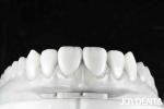 Revolutionize Your Dental Practice with Natural Tooth Morphology Tooth
