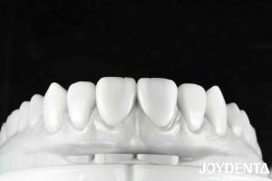 Quality Revolutionize Your Dental Practice with Natural Tooth Morphology Tooth Arrangement Technology and Lightweight Property wholesale