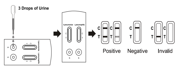 Streptococcus Pneumoniae Legionella Pneumophila Test Infectious Disease Test Kit