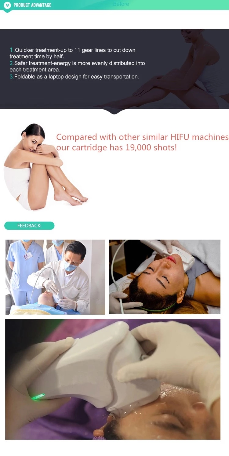 Effective 3D hifu face lifting machine/11 lines 3d hifu wrinkle removal machine for sell
