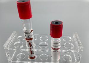 Quality No Anticoagulant 2ml Blood Vacuum Container Common Rapid Serum Tube wholesale
