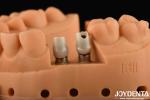 Silver Color Dental Zirconia Abutments For Implants Customizable Diameter