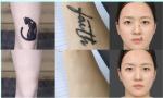 3 Wavelength laser tattoo removal equipment Portable Tattoo Removal Machine