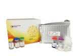96 Wells 48 Wells Human CRH ELISA Kit Strong Sensitivity