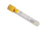 Yellow Clot Activator Gel Separator 9ml 10ml Serum Gel Clot Activator Tube