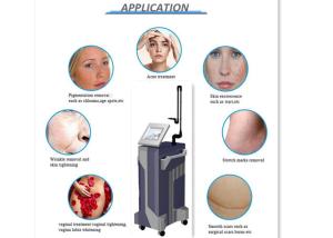 Quality Pigment Removal Touchscreen Co2 Fractional Laser Machine Air Cooling wholesale