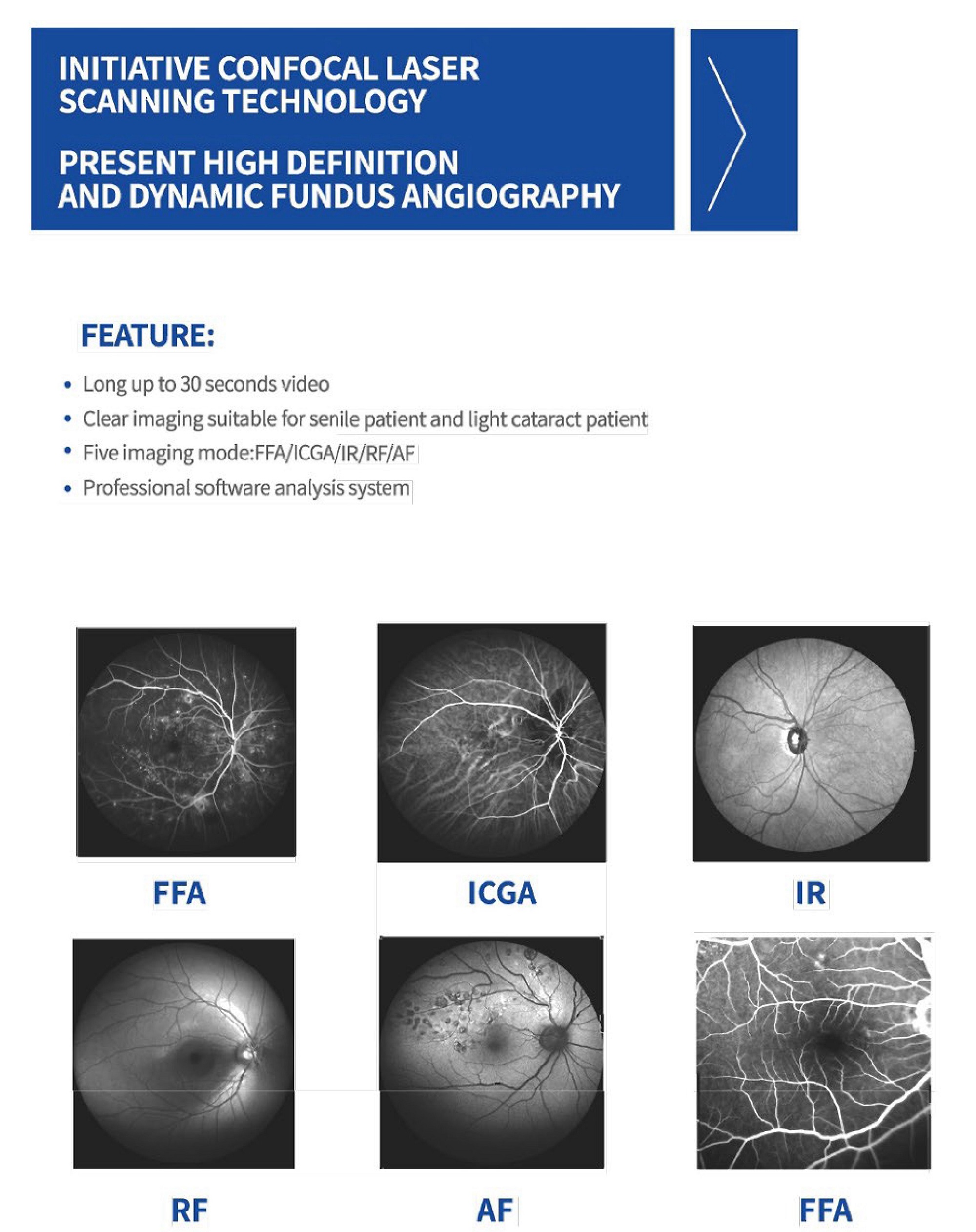 Confocal Retina Ophthalmoscope One Integrated Lens Camera System Multi Imaging Modes