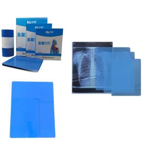 Quality Free Sample Inkjet X Ray Paper Film Imaging Printed By Printer For Radiology Medical Diagnosis 8*10 Printer wholesale