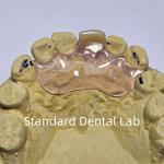 Dental TCS Valplast Flexible Partial Dentures Staining Fading Odors Resistant
