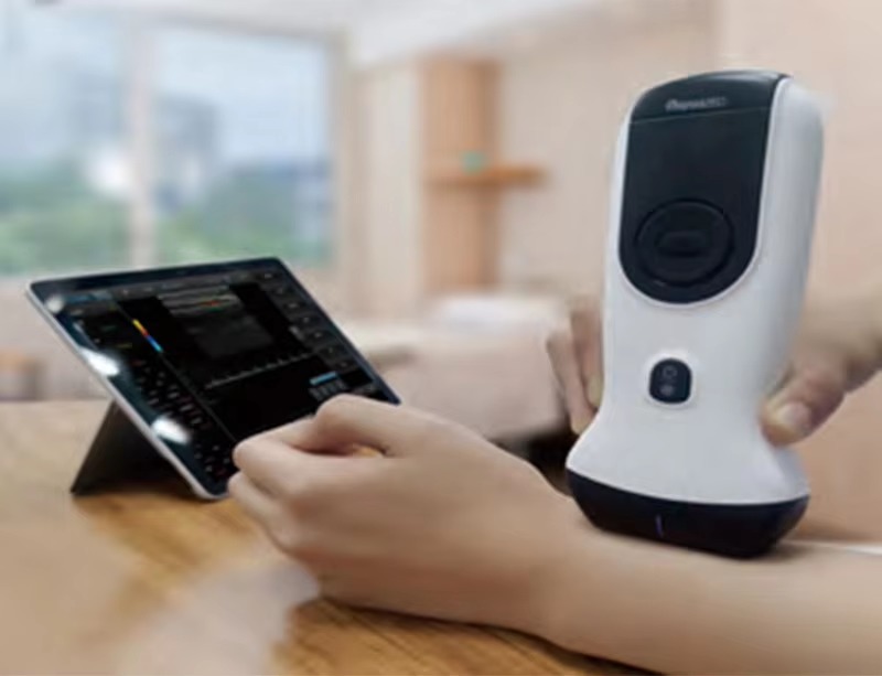 2025 Best Handheld Ultrasound | NMPA Approved with HD Frame Rate