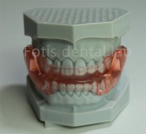 Quality OEM Orthodontic Retainer Expander All Sizes Compatible With Most Orthodontic Treatments wholesale
