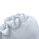 Repair Type Modeling Resin Dental 1kg / Bottle