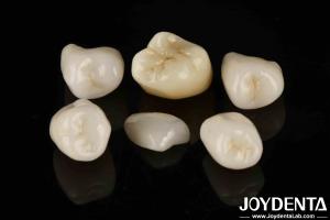 Quality Easy Cementation Emax Inlay Onlay Medium Strength Natural-looking Esthetics wholesale