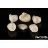 Buy cheap Easy Cementation Emax Inlay Onlay Medium Strength Natural-looking Esthetics from wholesalers
