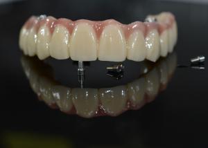 Quality Zirconia Dental Crown: Natural-looking Teeth, Durable &amp; Secure wholesale