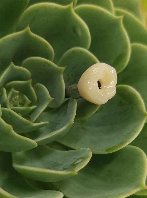 Great Biocompatibility ANKYLOS Dental Implant Supported Crown