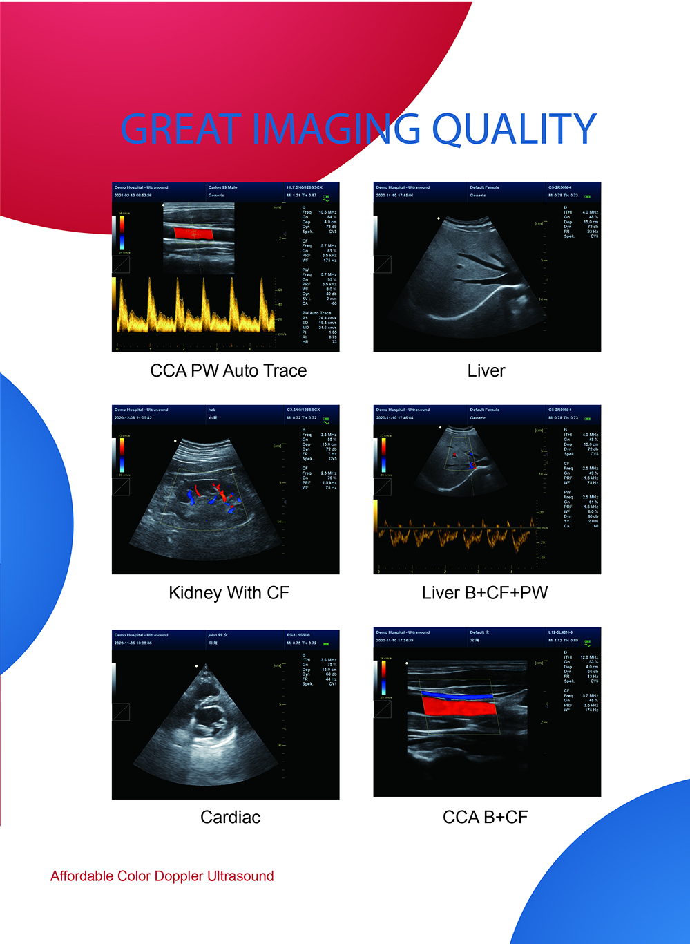 CONTEC CMS1700B Color Doppler Professional Diagnostic cardiology Ultrasonic Diagnostic System echocardiography machine p