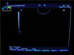 Hitachi EUP-V53W Endocavity 10mm Ultrasound Transducer Probe