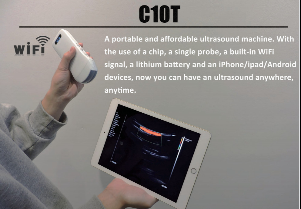 128 Elements Medical Hospital Equipments Color Doppler Portable Wireless Ultrasound Machine 3 In 1