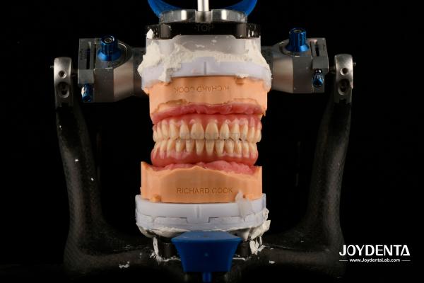 Lightweight Comfortable Fit Acrylic Dental Denture Finish Professional