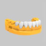 3D Printed Bleach Temporary Veneer Resin for Dental Restorations