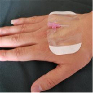 Adhesive Disposable Transparent Film Dressings 10*10cm Antibacterial Antitear