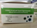 13*100mm Rapid Virus Sampling Diagnostic Test Kit