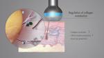 LDM Dual Frequency Skin Care Machine Ultrasound Hydra Facial Rejuvenation