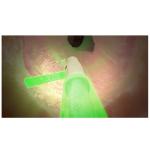 AURORA Laboratory Medical Equipment High Power Green Laser BPH Surgery System