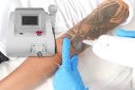 J300 Pigment Removal Best Selling 1064nm 532nm 1320nm Q Switched Nd Yag Laser