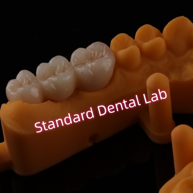 High Translucent PFZ Layered Zirconia Bridge Porcelain Ceramic Posterior