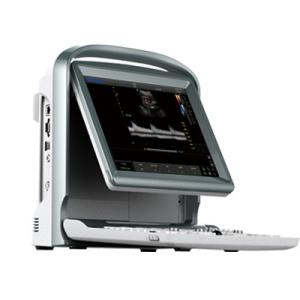 Quality LED Display Color Doppler Portable Ultrasound Scanner with CE wholesale