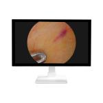 Medical Endoscopic 32 Inches 4K UHD High Definition Medical Monitor For Surgery