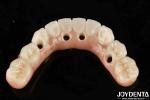 Titanium And Zirconia Comfort Comfortable To Wear Ti-Bar Zirconia Hybrid Bridge