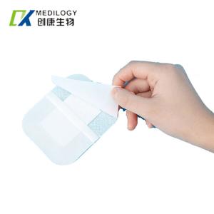 Quality Spun Laced PU Film Dressing Disposable Polyurethane Film Dressing Indwelling wholesale