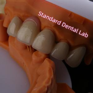 Quality Highly Biocompatible PFZ Porcelain Layered Zirconia With Pink Gum wholesale