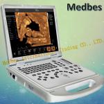 High Efficiency Color Doppler Ultrasound Diagnostic System Medical Equipment